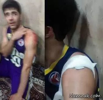 ملی پوش بسکتبال ایران با ضربه چاقو زخمی شد