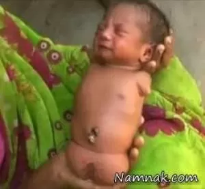 تولد نوزاد عجیب بدون دست و پا + تصاویر