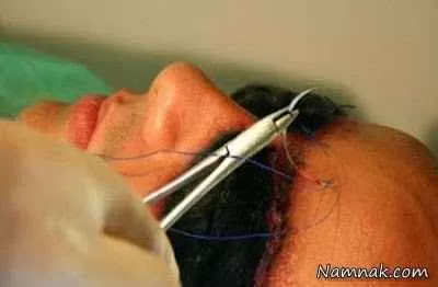 عجیب ترین جراحی صورت در دنیا + عکس