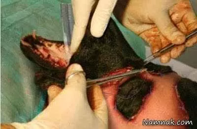 عجیب ترین جراحی صورت در دنیا + عکس