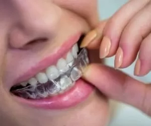 اثر مخرب جرم گیری بر مینای دندان