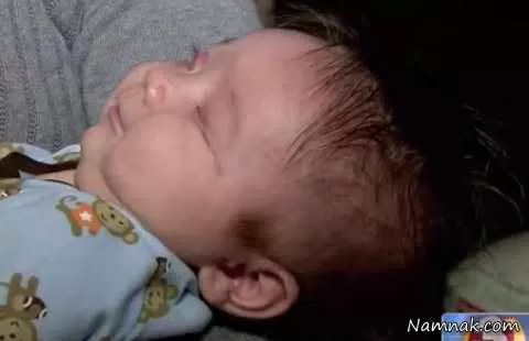 نوزاد بدون چشم امریکایی