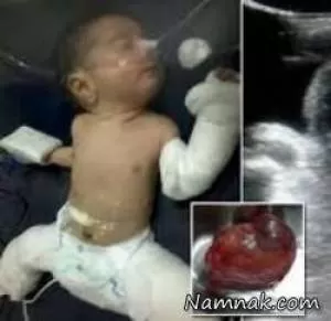 نوزاد باردار، پسربچه 9 روزه زایمان کرد! + تصاویر+14
