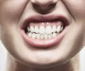 از کجا بدانیم دچار دندان قروچه شبانه هستیم؟