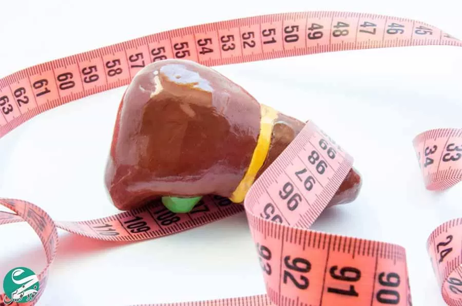 کاهش وزن برای درمان کبد چرب و نکاتی که باید بدانید + رژیم غذایی مناسب کبد چرب