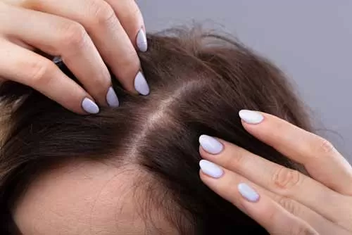 10 روش ضخیم شدن موی سر زنان و مردان و تقویت موی سر
