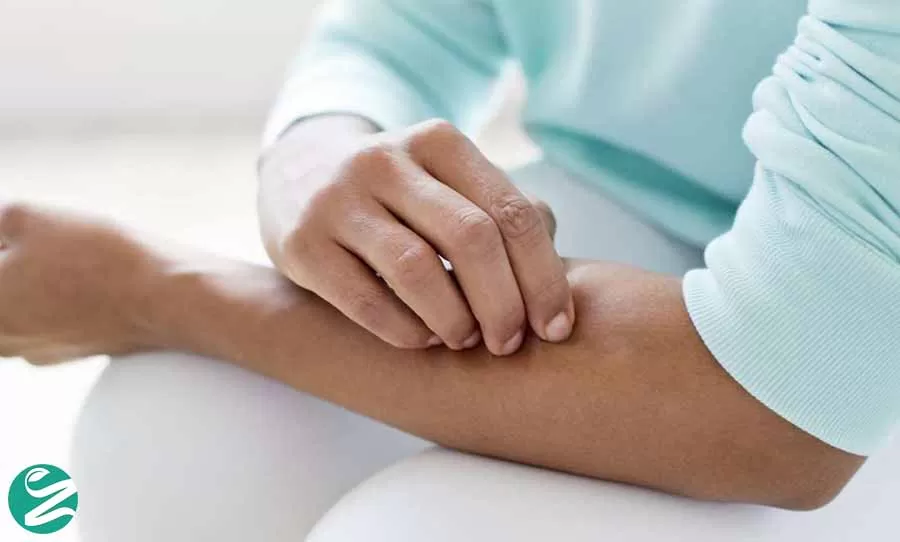 عفونت پوست چیست؟ از تشخیص تا درمان انواع عفونت های پوستی